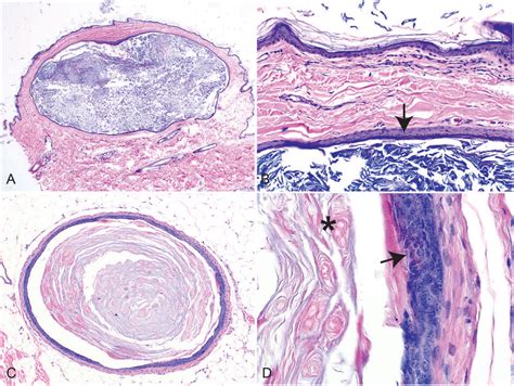 Epidermal and Hair Follicle Tumors in Animals